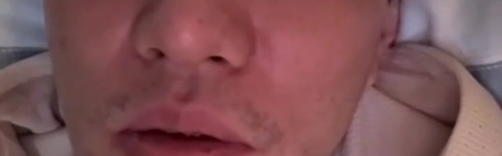 DG视讯官网平台太恐怖了😱！郭艾伦：缝了四十多针 经历了人生最恐惧绝望时刻
